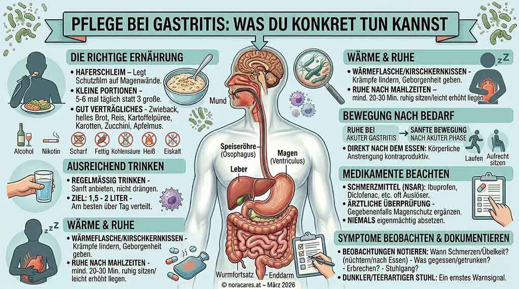 German-language infographic with concrete care tips for gastritis. In the center, the digestive system with stomach and esophagus is shown. Around it are notes on suitable nutrition, drinking enough, warmth and rest, adapted movement, paying attention to medication, as well as observing and documenting symptoms. Among other things, it mentions oat porridge, small portions, avoiding alcohol, nicotine, and spicy foods, as well as warning signs such as vomiting or dark, tar-like stool. The headline reads “Care for gastritis: What you can concretely do