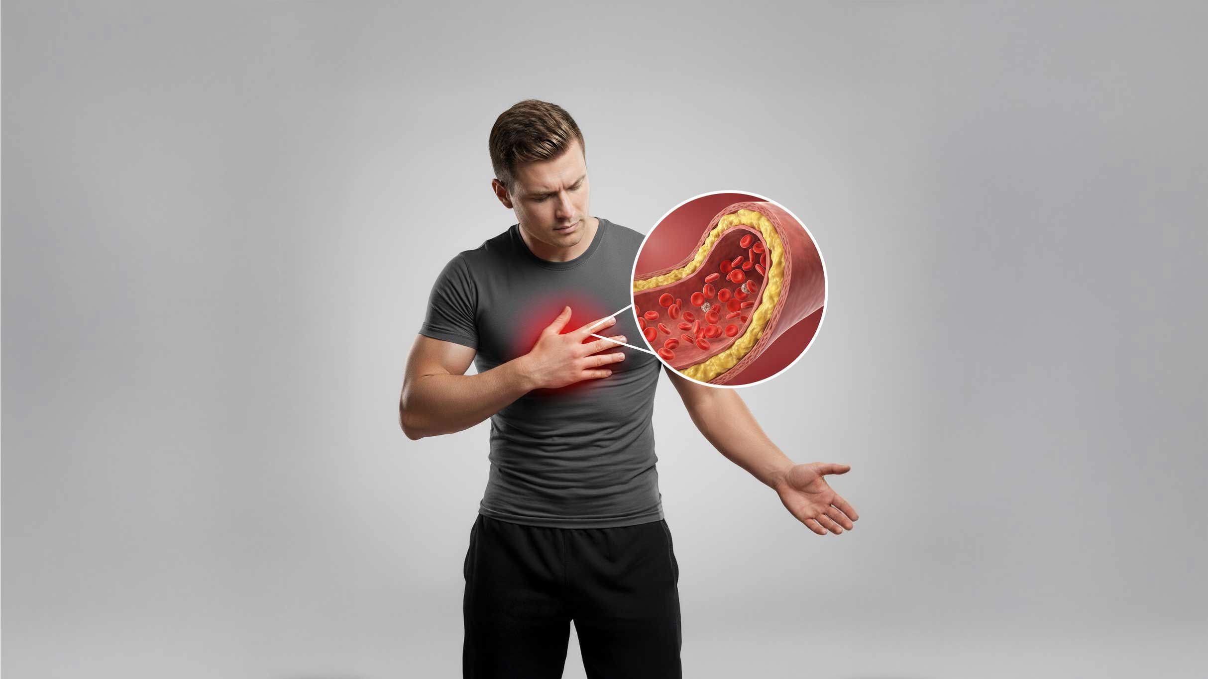 Care ABC – C is for Cholesterol